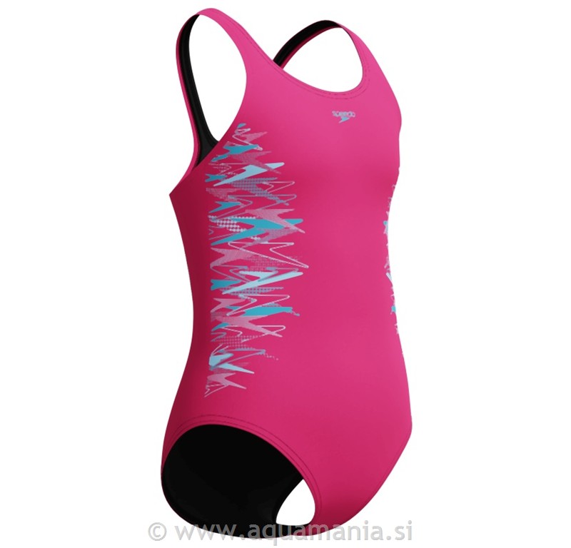 ENODELNE KOPALKE - PLACEMENT MUSCLEBACK